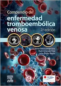 Compendio de enfermedad tromboembólica venosa, 2.ª edición (Original PDF from Publisher)