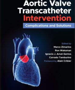 Aortic Valve Transcatheter Intervention: Complications and Solutions (EPUB)