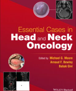Essential Cases in Head and Neck Oncology (EPUB)