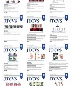 The Journal of Thoracic and Cardiovascular Surgery 2023 Full Archives (True PDF)