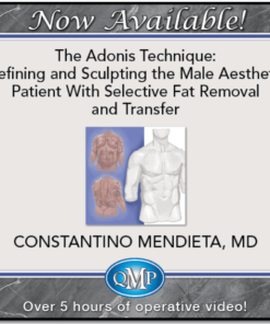 QMP The Adonis Technique Defining and Sculpting the Male Aesthetic Patient With Selective Fat Removal and Transfer 2025
